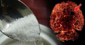 Leaked Emails Claim Aspartame is Causing Holes in Our Brains?