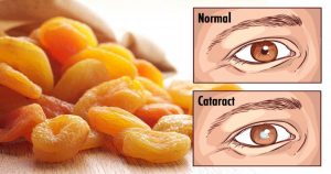 20 Foods to Consume for a Better Eyesight