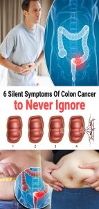 6 Silent Symptoms Of Colon Cancer to Never Ignore