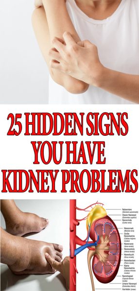 25 Hidden Signs You Have Kidney Problems